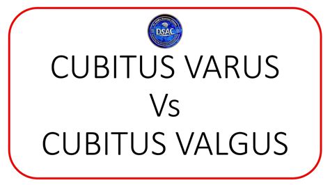 Cubitus varus and cubitus valgus deformity, Gunstock deformity of elbow, Carrying angle of elbow ...