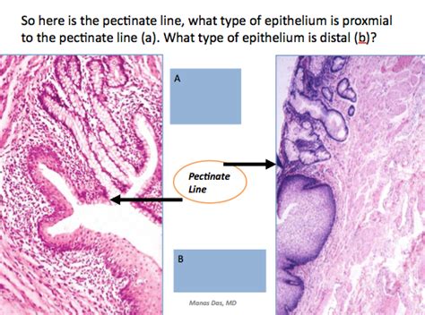 Pectinate Line Histology