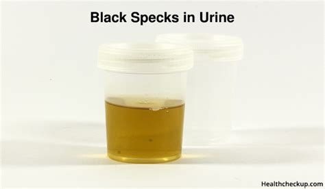 Tiny Black Specks In Urine