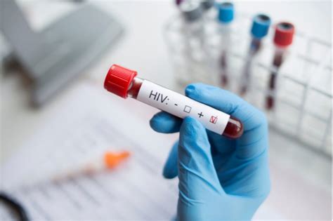 New hope as trial of HIV vaccine begins - Adomonline.com