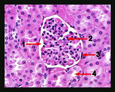 Simple Squamous 1