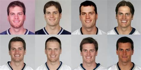 Has Tom Brady Had Work Done? Plastic Surgery Twitter Thinks So