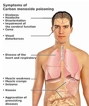 Carbon monoxide poisoning - Wikipedia