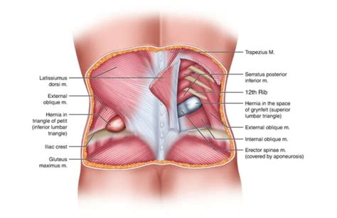 Does a Hernia Cause Back Pain? Let's Find Out | ASPC Manipulation Therapy