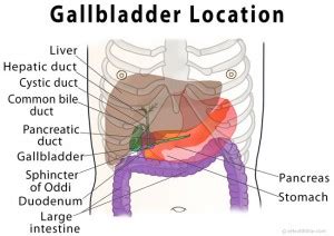 Gallbladder Pain Location Diagram, Symptoms, Causes, Relief - eHealthStar