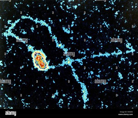 Scanning Electron Microscope Stock Photos & Scanning Electron ...