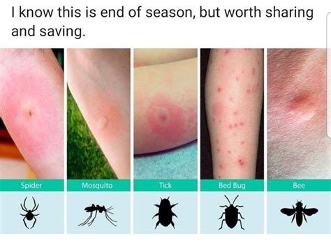 Pin by Heather Saunders on camping | Identifying bug bites, Bug bites, Insect bites