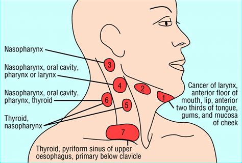 Lymph Nodes In Neck Diagram Location