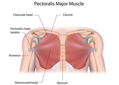 Pectoralis Major Tendon Tear | Orthopedic Shoulder Doctor | Manhattan, New York City, and New ...