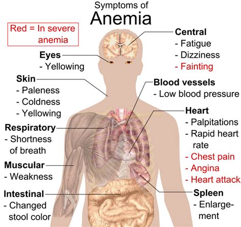 Difference Between Anemia and Iron Deficiency | Clinical Features ...