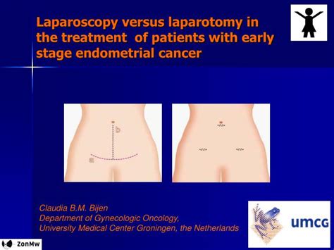 PPT - Laparoscopy versus laparotomy in the treatment of patients with early stage endometrial ...