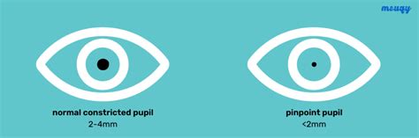 Pinpoint Pupils: Why Are My Pupils Small?