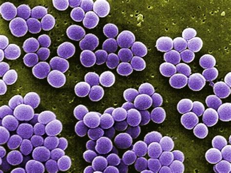 S aureus Infection Associated With Higher Mortality in RA - Infectious ...