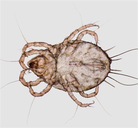 Dust mite bites | Fact or fiction? | Read our expert guide - us.klarify