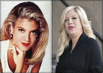 Tori Spelling | Celebrities then and now, Celebrity plastic surgery ...