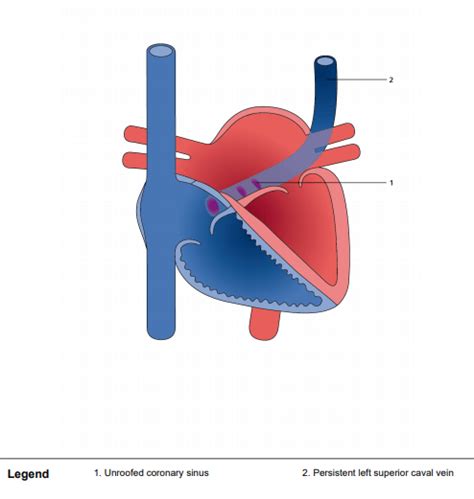 Unroofed coronary sinus with persistent left superior caval vein - Perfusfind