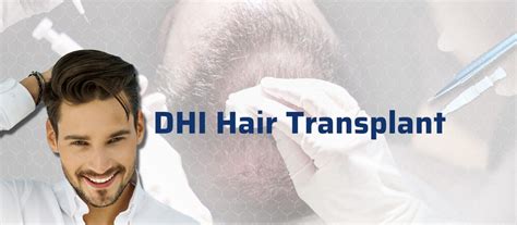 DHI Hair Transplant | ClinicExpert International