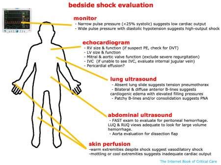 Approach to shock & refractory shock - EMCrit Project