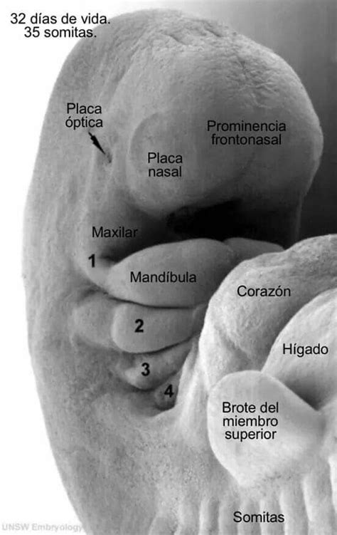 Medicine Notes, Medicine Studies, Dental Anatomy, Medical Anatomy, Anatomy Head, Studying ...