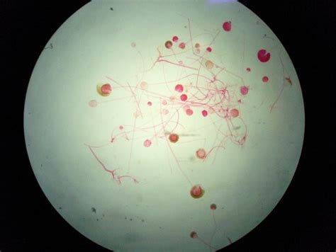 rhizopus nigricans sporangia black bread mold | tamaracikic17 | Flickr