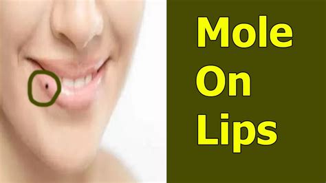 Mole On The Lower Lip Meaning - Infoupdate.org