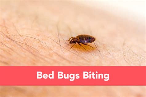 Bed Bugs Rash Treatment