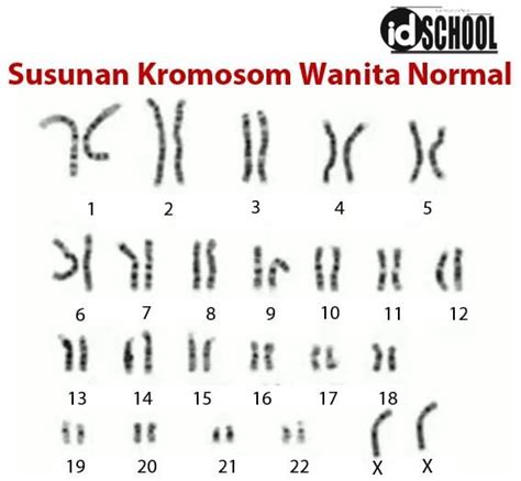 Jumlah Kromosom Manusia Normal dan Dengan Kelainan – idschool.net