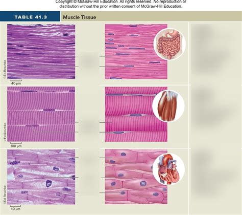 Skeletal Muscle Tissue Labeled Diagram