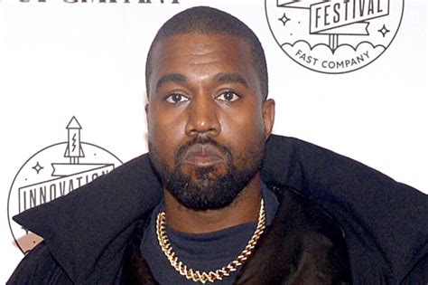 Kanye West Roasted for Lip 'Bubble' After Getting $850K Dentures