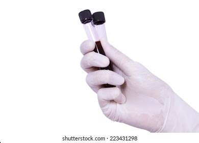 Doctor Scientist Hands Wear Rubber Gloves Stock Photo 2229215737 ...