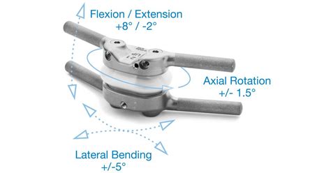 Premia Spine Launches TOPS™ System IDE study