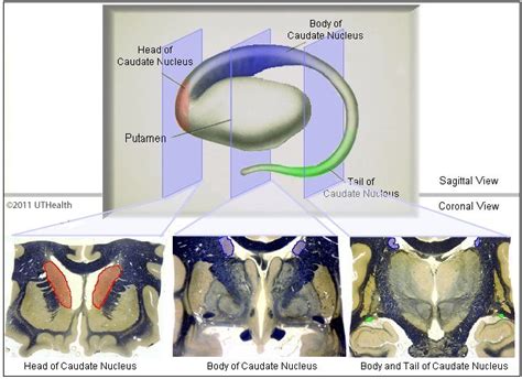 Neuroanatomy Online: Lab 2 - Internal Organization of the Brain - Caudate Nucleus