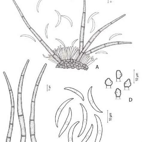 Colletotrichum gossypii on cotton: A. Acervulus; B. Setae; C. Conidia;... | Download Scientific ...