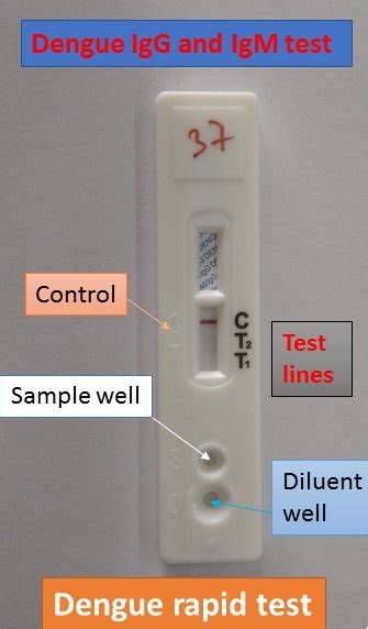 Dengue rapid test for IgG and IgM Detection: Introduction, Principle, Pro