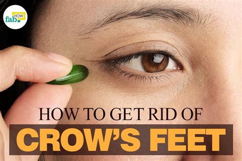 How to Get Rid of Crow's Feet without Botox | Fab How