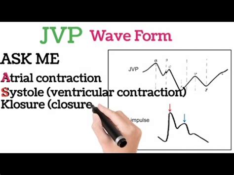 JVP waveform || Jugular Venous Pressure || Medical Mnemonic For JVP waveform - YouTube