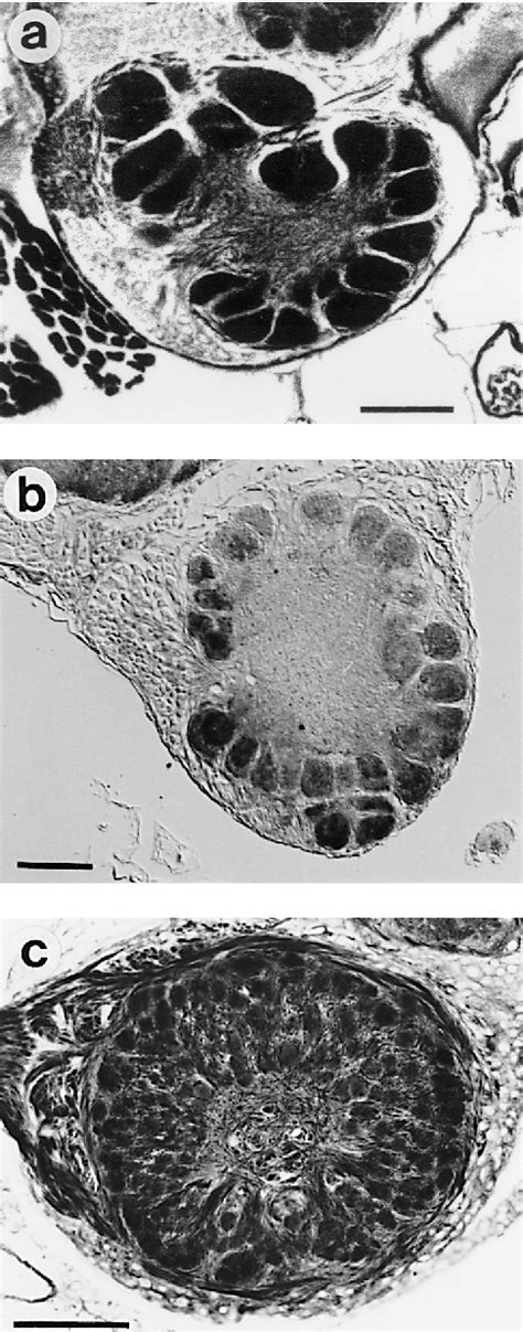 Figure 1 from The Antennal Lobe of Orthoptera – Anatomy and Evolution | Semantic Scholar