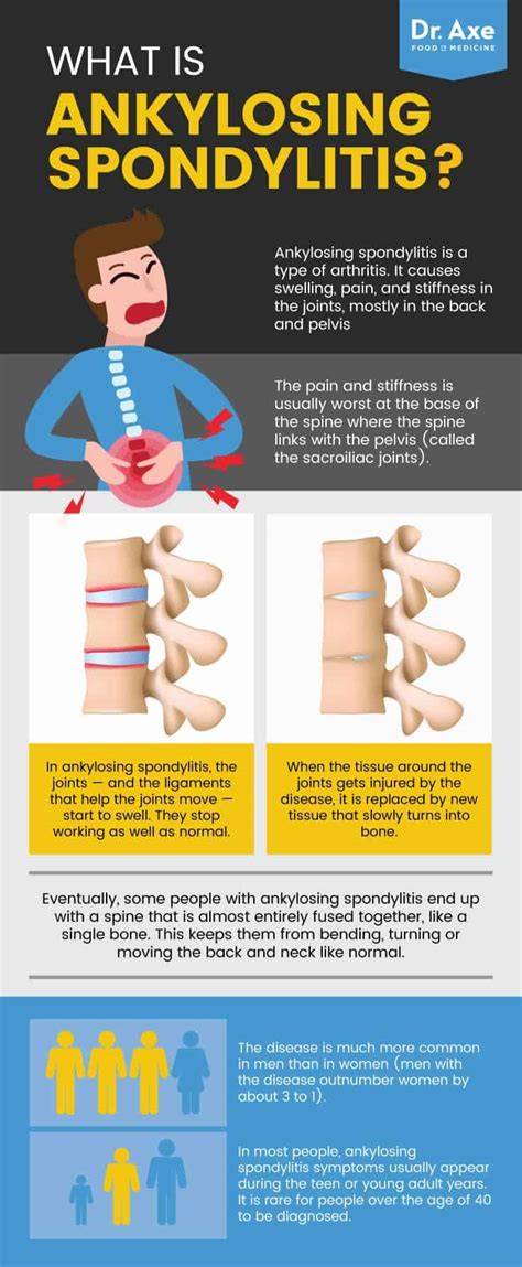 Ankylosing Spondylitis Symptoms + 13 Ways to Manage Self-Care