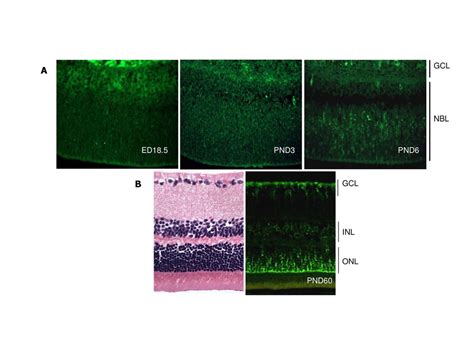 GCL A NBL ED18.5 PND3 PND6 B GCL Figure 1: Spatio-temporal expression of cadherin-11 in the ...