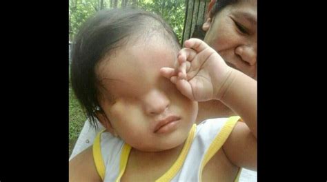 KMJS Features 1-year-old Jhon Dave born without eyes (Full Video) - AttractTour