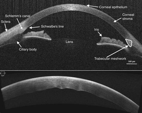 Anterior segment optical coherence tomography and its clinical ...