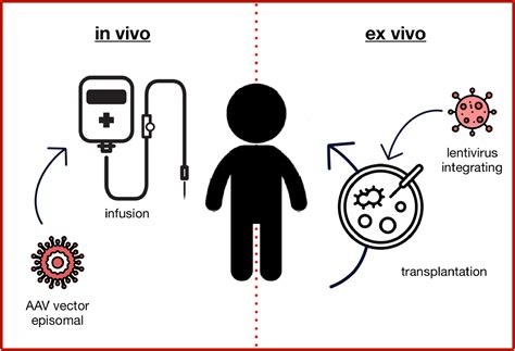 Postnatal gene therapy for neuromuscular diseases – opportunities and ...