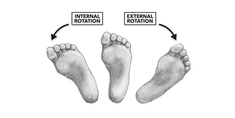 Lateral Rotation Of Hip