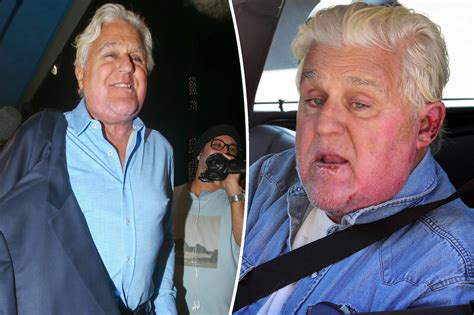 Jay Leno bromea que la cara está «mejor» que antes después del accidente - Play Trucos