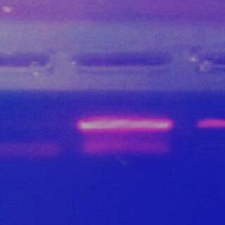 Colony PCR Loading sequence: 1)Negative Control:10μL 2)Colony V-10μL 3 ...