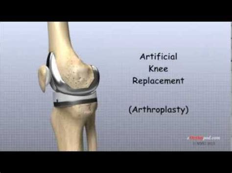 Orthopaedics treatments | Orthopaedic and Spine Care Clinic