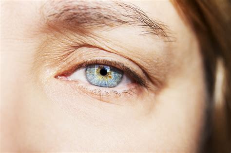 Drooping Eyelids Can Affect Your Vision | Sight Eye Clinic Explains