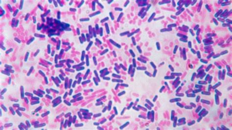 Salmonella Enterica Gram Stain