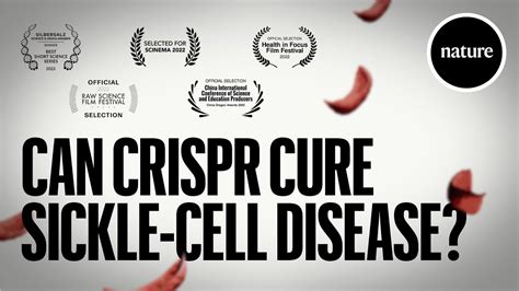 Can CRISPR cure Sickle-cell Disease? - YouTube