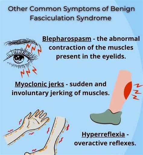 These are the symptoms of Benign fasciculation syndrome - MEDizzy